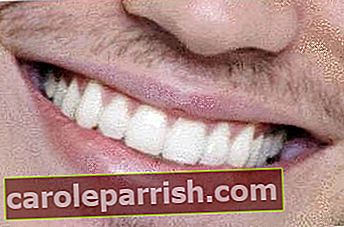 하얀 치아