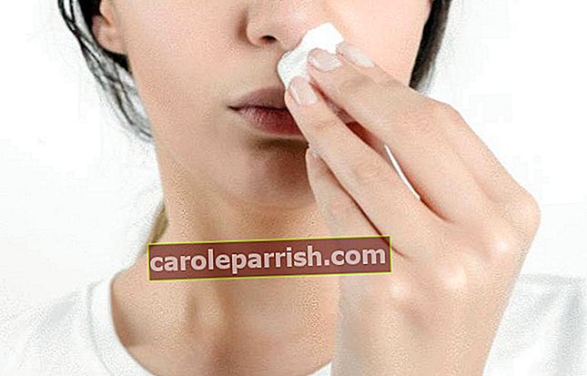 Eine brünette Frau heilt ihre Narbe über den Lippen